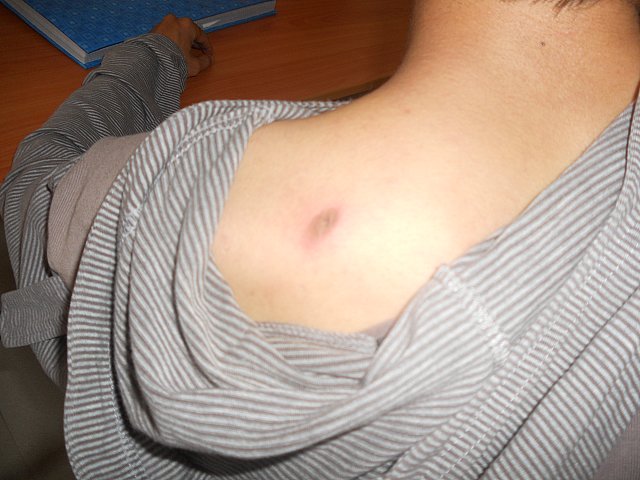 The police beat Quoc Anh with electric clubs. (Source: Dan Lam Bao)